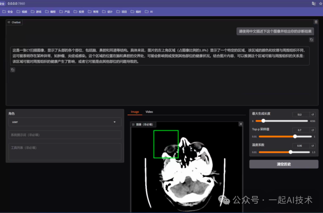 我训练了一个医疗多模态大模型帮家里老人看病